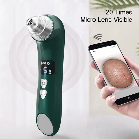 Visual Blackhead Remover Pore Cleanser Blackheads and Acne